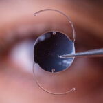 cataract lenses