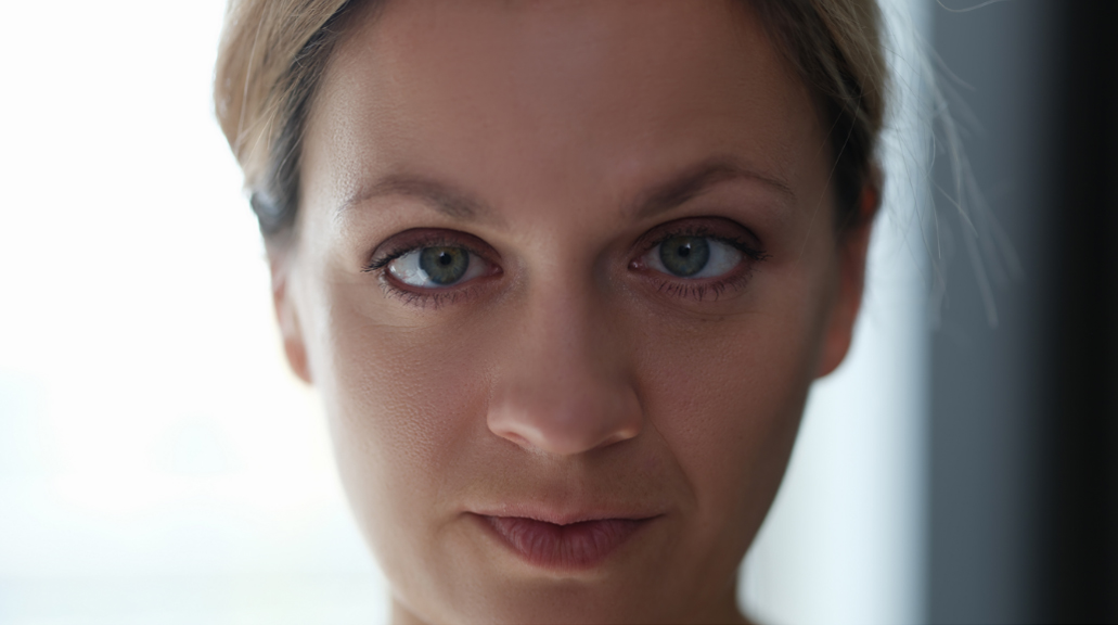 Close of of woman's face and eyes which shows she has amblyopia 
